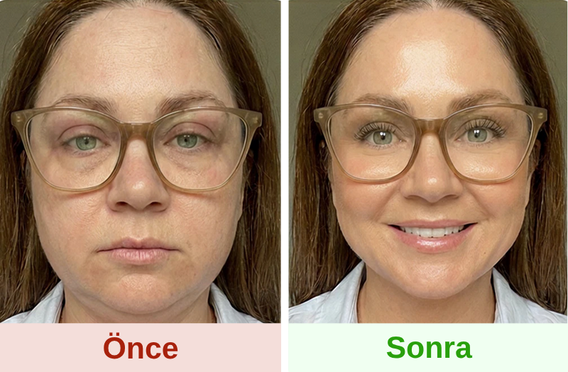 lymphatic drainage supplements